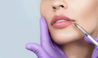 The Evolution of Lip Fillers: Insights into the Past, Present, and Future of Lip Enhancement