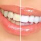 Keeping Your Smile Bright: Everyday Habits for Optimal Dental Health