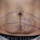 Thinking About a Tummy Tuck? Here's What You Need to Know