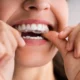 Common Pediatric Dental Issues and How Invisalign Can Help