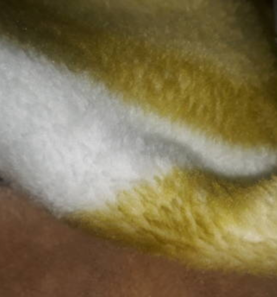 Wollmatten About Everything You Need to Know